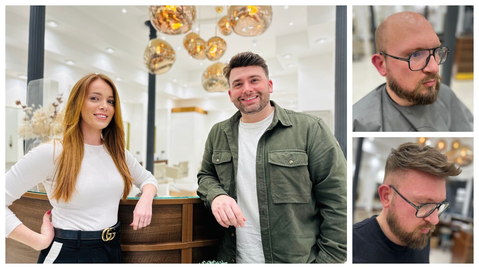 Altrincham clinic is first to offer “amazing” hair replacement system